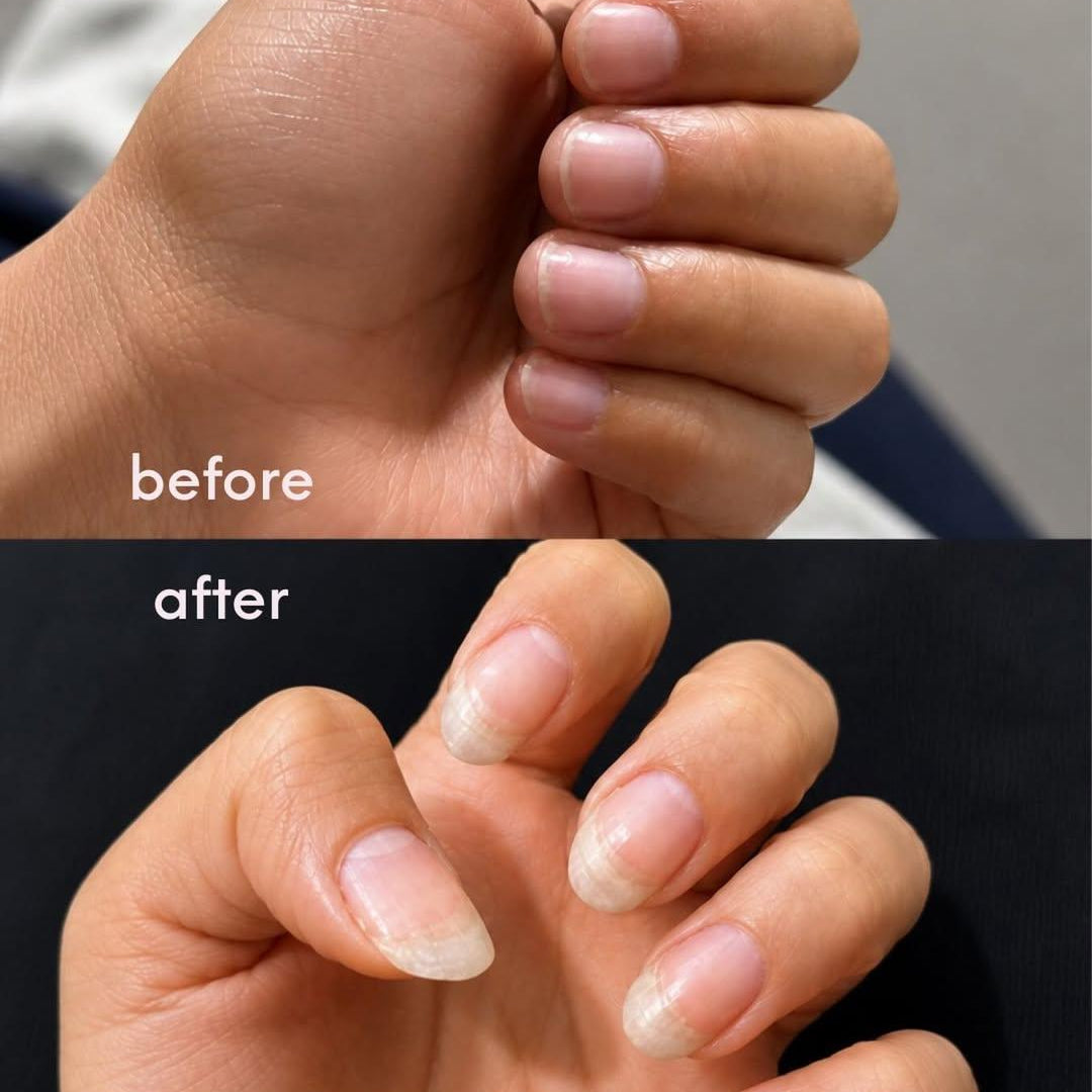 Nail Growth Oil