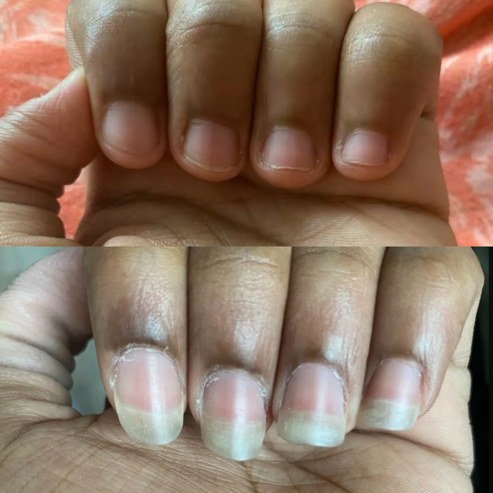 Nail Growth Oil